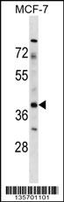 ZAR1 Antibody