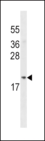 ADI1 Antibody