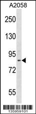 ADAM23 Antibody