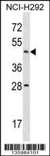 ACTL7B Antibody