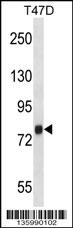 ZC3H14 Antibody