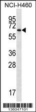 ZBTB46 Antibody