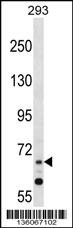 ZNF214 Antibody