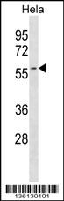 AUP1 Antibody