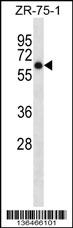 ARSD Antibody