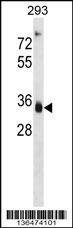 AKR1D1 Antibody