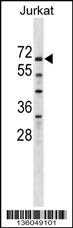 ZNF498 Antibody