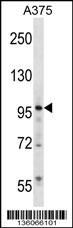 ZNF541 Antibody