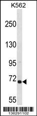 ARHGEF6 Antibody