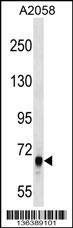 ARHGEF5 Antibody