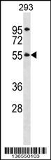 TTC8 Antibody