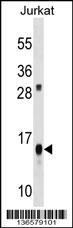 ATP5D Antibody