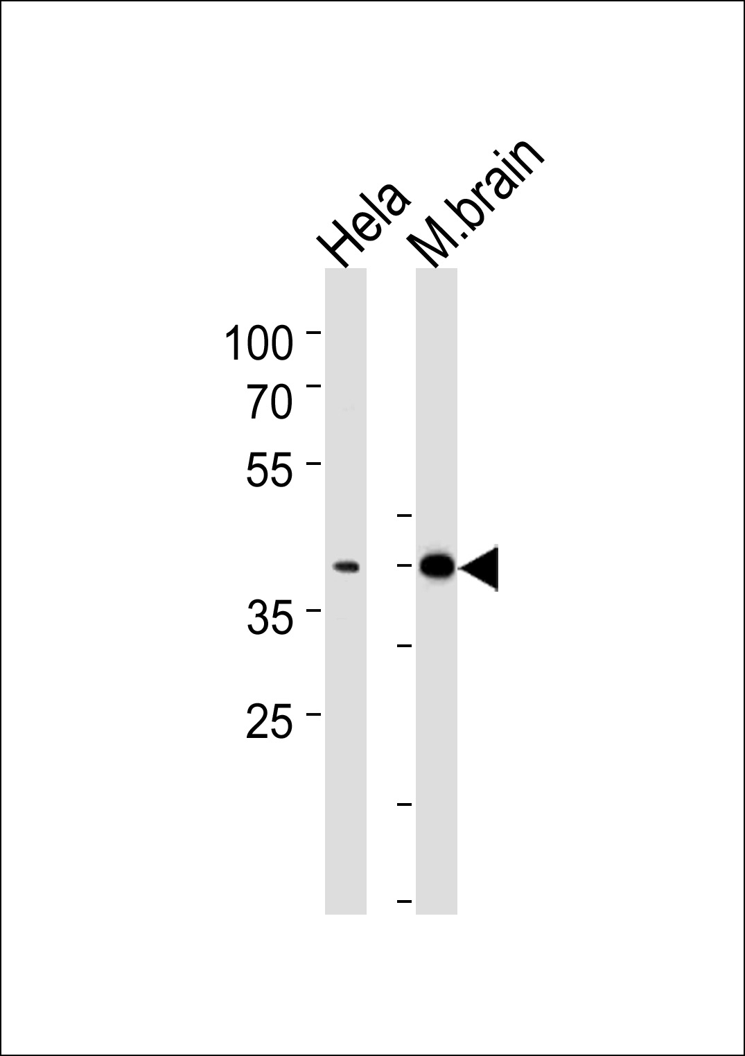 ATF2 Antibody