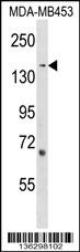 ARHGEF11 Antibody