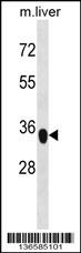 YIPF3 Antibody