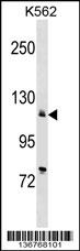 ATP2A2 Antibody