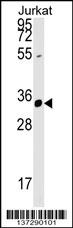ZFYVE27 Antibody