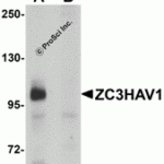 Western blot analysis of ZC3HAV1 in HeLa cell lysate with ZC3HAV1 antibody at 1μg/mL in (A) the absence and (B) the presence of blocking peptide.