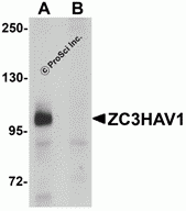 ZC3HAV1 Peptide