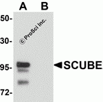 Western blot analysis of SCUBE2 in Daudi cell lysate with SCUBE2 antibody at 1 μg/mL in (A) the absence and (B) the presence of blocking peptide.