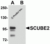 SCUBE2 Peptide