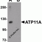 Western blot analysis of ATP11A in K562 cell tissue lysate with ATP11A antibody at 1 μg/mL in (A) the absence and (B) the presence of blocking peptide.