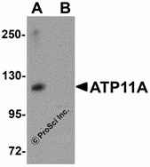 ATP11A Peptide