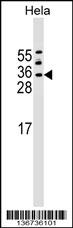 ASF1A Antibody