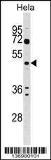 ALG2 Antibody