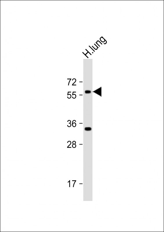 ASB2 Antibody