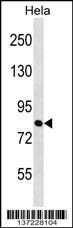 ZNF131 Antibody