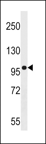 AGAP3 Antibody