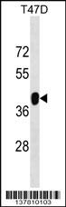 ZNF322A Antibody