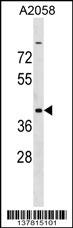 ADAT3 Antibody