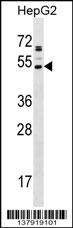 AADACL2 Antibody