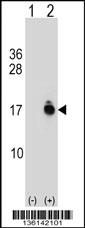 ACYP1 Antibody
