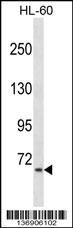 AKAP8L Antibody