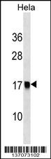 AP2S1 Antibody