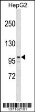 ARID5B Antibody