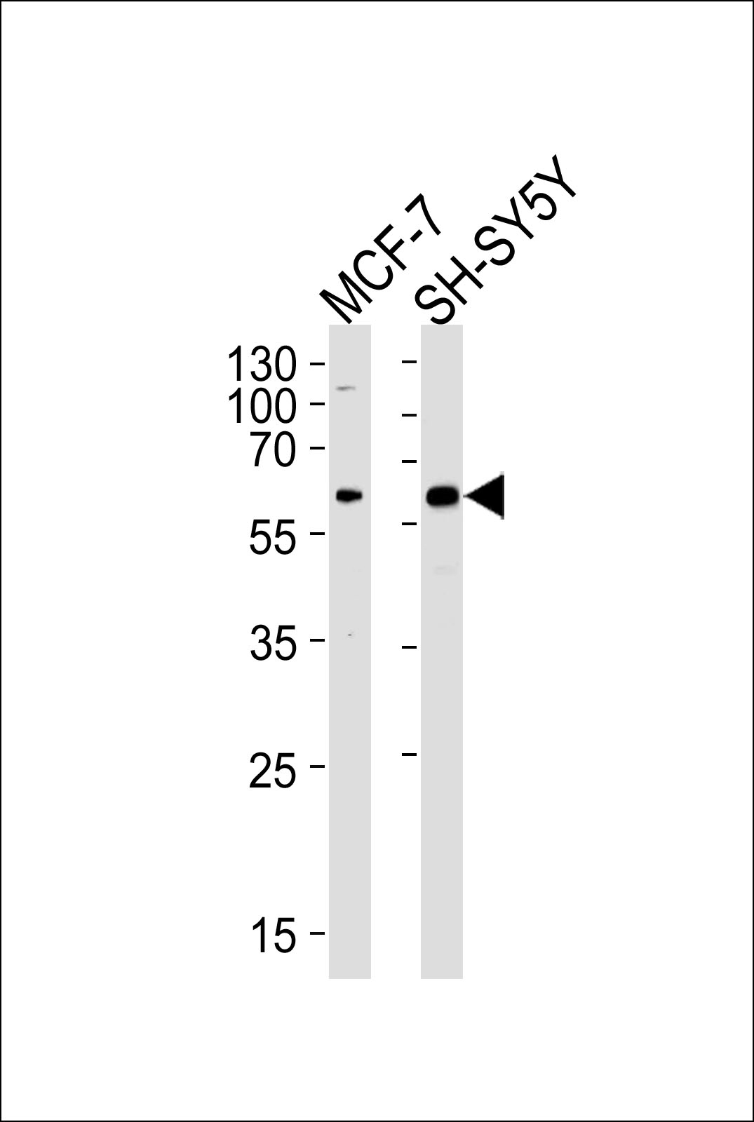 ZBTB22 Antibody