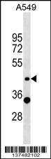 ZNF19 Antibody