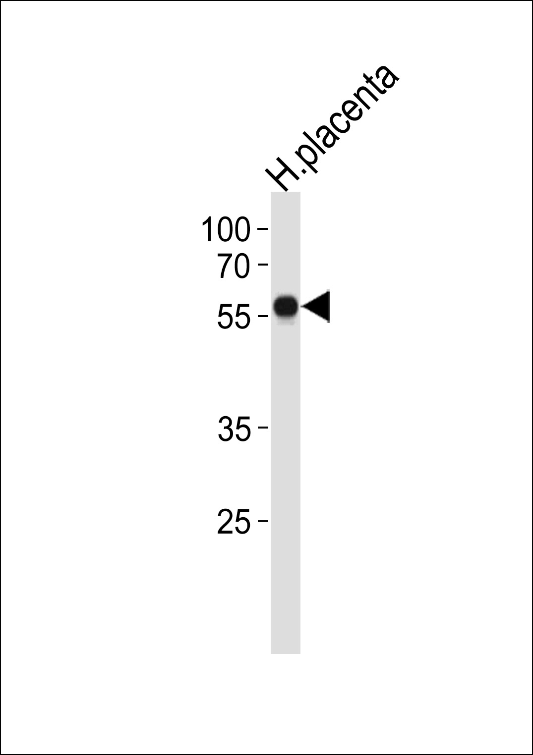 ZNF71 Antibody