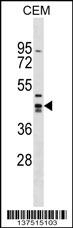 ZNF193 Antibody