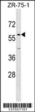 ZNF10 Antibody