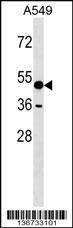 AMY1A Antibody
