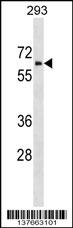 ZNHIT6 Antibody