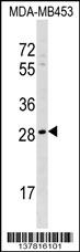 AIDA Antibody