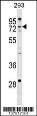 ZCCHC8 Antibody