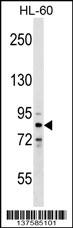 ZNF224 Antibody