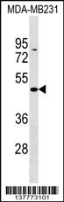 ZBTB25 Antibody